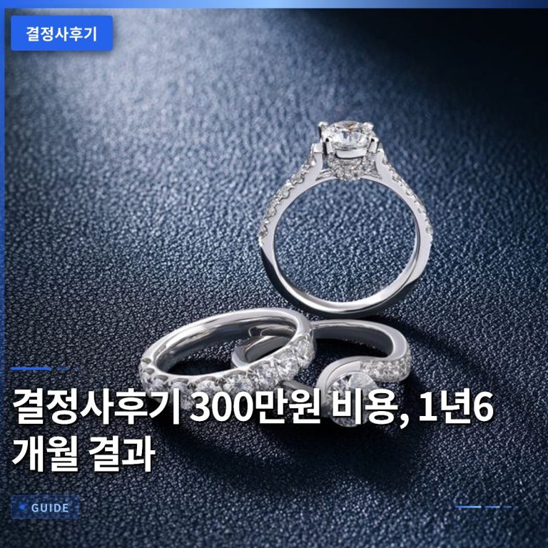 결정사후기 300만원 비용, 1년6개월 결과